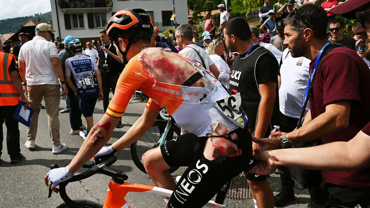 Carlos Rodr&iacute;guez tras sufrir una ca&iacute;da en el Tour de Romand&iacute;a de 2026
